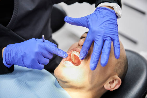 Best Emergency Dentist for Lost Fillings or Crowns in Defiance, OH