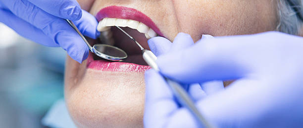 Best Emergency Dentist for Lost Fillings or Crowns in Defiance, OH